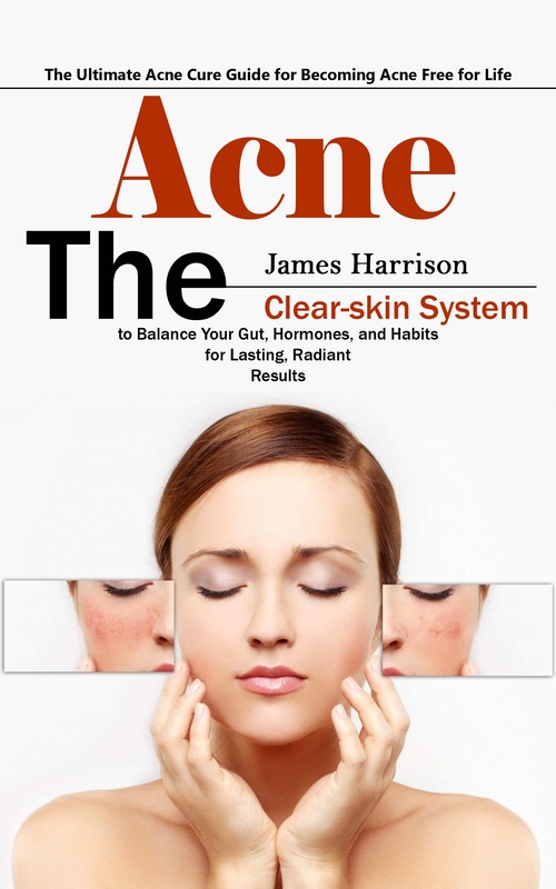 ebook cover of Acne: The Ultimate Acne Cure Guide for Becoming Acne Free for Life (The Clear-skin System to Balance Your Gut, Hormones, and Habits for Lasting, Radiant Results), by James Harrison
