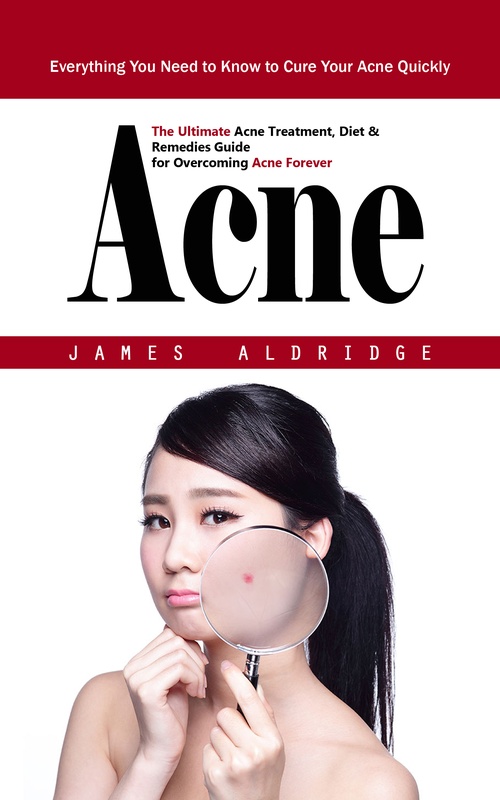 Couverture ebook de Acne: Everything You Need to Know to Cure Your Acne Quickly (The Ultimate Acne Treatment, Diet & Remedies Guide for Overcoming Acne Forever), de James Aldridge