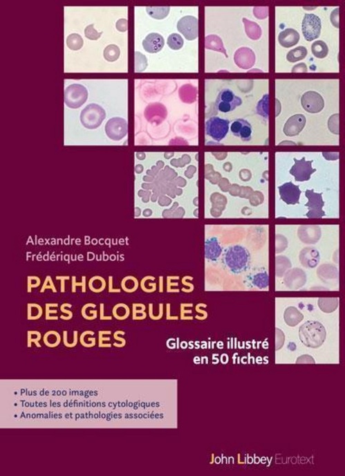 ebook cover of Pathologies des globules rouges, by Alexandre Bocquet, Frédérique Dubois