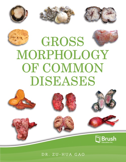 Couverture ebook de Gross Morphology of Common Diseases, de