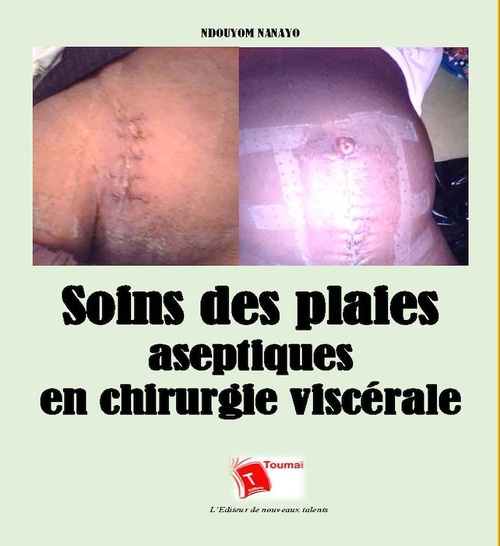 ebook cover of Soins des plaies aseptiques en chirurgie viscérale, by Nanayo Ndouyom