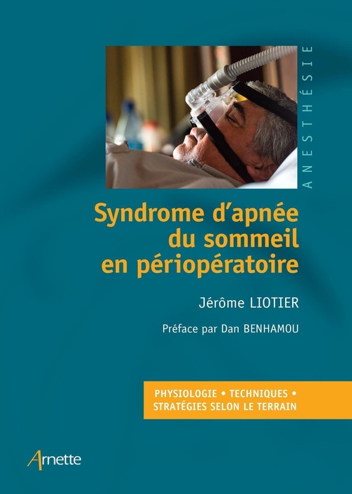 Couverture ebook de Syndrome d'apnée du sommeil en périopératoire, de Jérôme Liotier