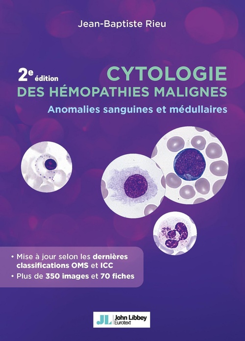 ebook cover of Cytologie des hémopathies malignes (2e édition), by Jean-Baptiste Rieu