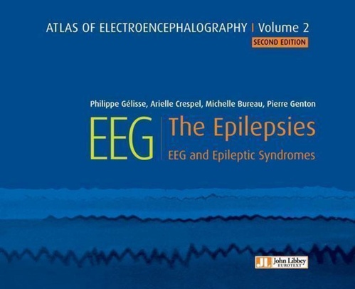 ebook cover of Atlas of electroencephalography Volume 2 : The Epilepsies. 2ED, by Philippe Gelisse, Arielle Crespel, Michelle Bureau, Pierre Genton
