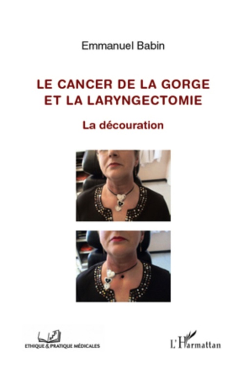 Couverture ebook de Cancer de la gorge et la laryngectomie, de Emmanuel Babin
