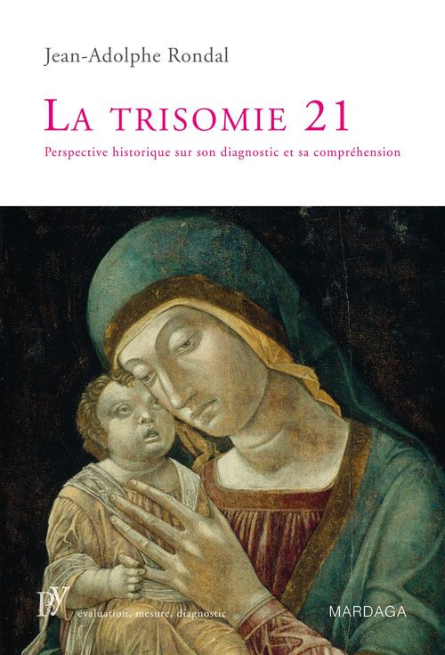 ebook cover of La trisomie 21, by J. Rondal