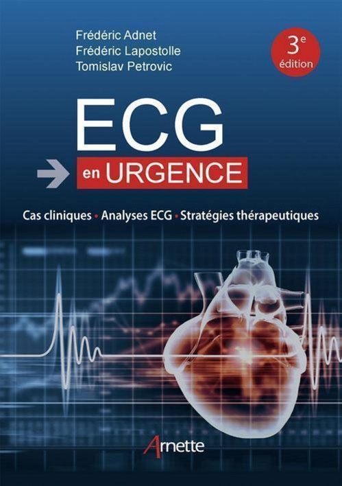 ebook cover of ECG en urgence (3e édition), by Frédéric Adnet, Frédéric Lapostolle, Tomislav Petrovic