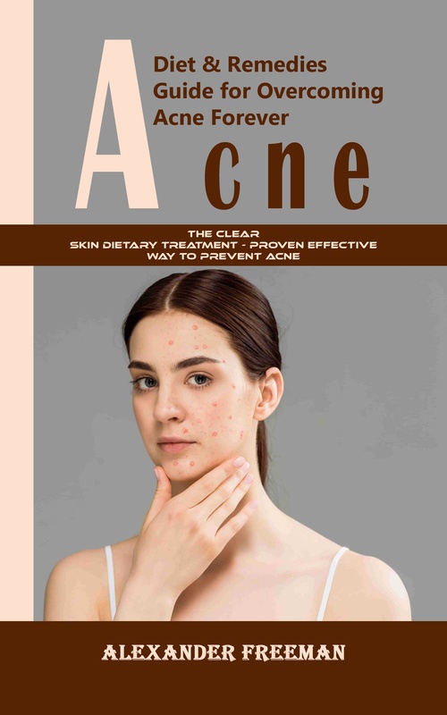 Couverture ebook de Acne: Diet & Remedies Guide for Overcoming Acne Forever (The Clear Skin Dietary Treatment - Proven Effective Way to Prevent Acne), de Alexander Freeman
