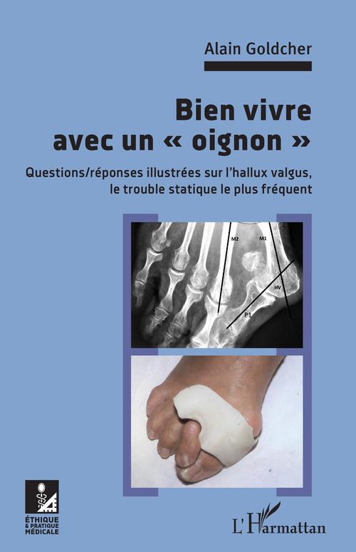 ebook cover of Bien vivre avec un "oignon", by Alain Goldcher