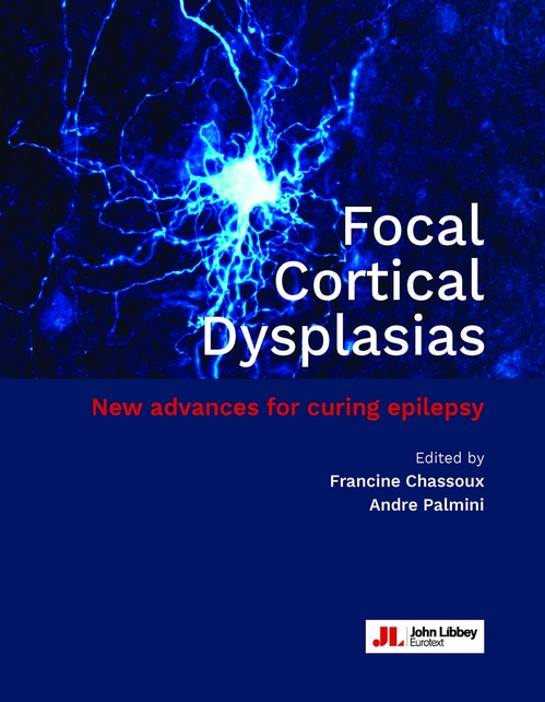 ebook cover of Focal Cortical Dysplasias, by Francine Chassoux, Andre Palmini