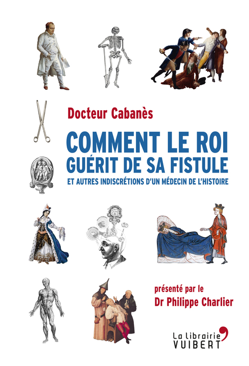 Couverture ebook de Comment le roi guérit de sa fistule, de Augustin Cabanès