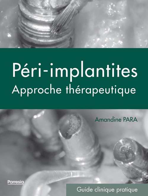 Couverture ebook de LES PÉRI-IMPLANTITES, de Amandine Para