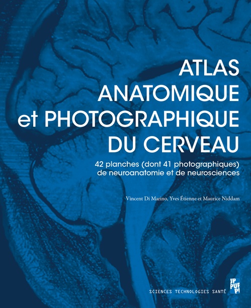 ebook cover of Atlas anatomique et photographique du cerveau, by Vincent Di Marino, Yves Etienne, Maurice Niddam